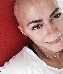 Novo nódulo de Sofia não é cancerígeno 