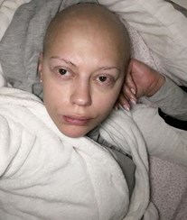 Sofia Ribeiro partilha foto impressionante da luta contra o cancro