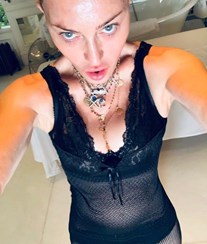 Madonna inicia tratamento "após oito meses de dor" e mostra como está o seu corpo