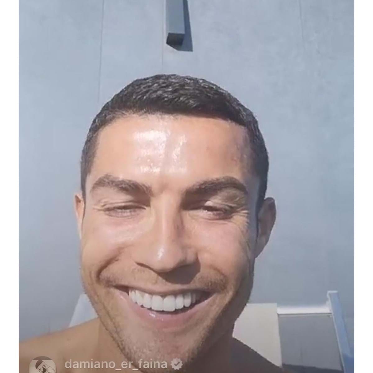 Fã de CR7, influenciador é diagnosticado com cefaleia em salvas